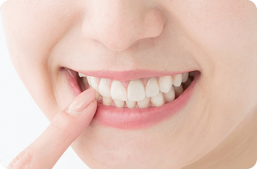 白い歯を見せる女性